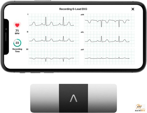 Medical-Grade & Doctor Tested 6-Lead Personal EKG Monitor Works with Almost All Smartphones | Generate Results in 30 Seconds