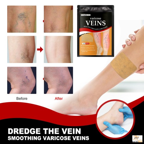 12PCS Veinhealth Varicose Veins Treatment Patch Spider Vein for Legs